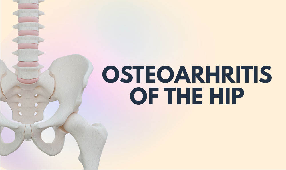 Osteoarthritis of the Hip and Pilates